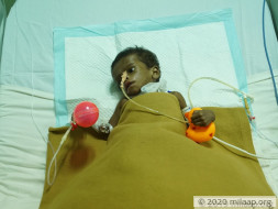 Help Baby Rabeeh Fight Extra Hepatic Biliary Atresia