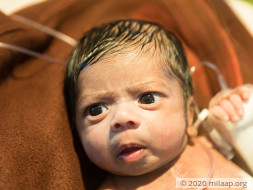 With A Scar Almost As Big As He Is, This Baby Is Struggling To Survive