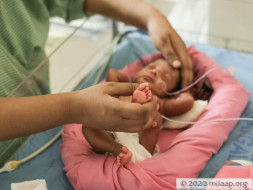 Help Sunitha's Twins Recover
