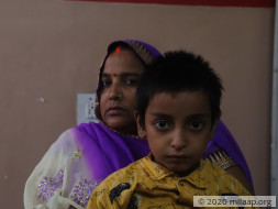 Krishna Bicuspid aortic valve disease