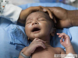 Born After 8 Years Of Marriage, Swapna's Baby Is Fighting To Survive