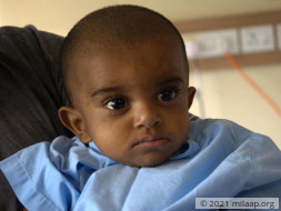 This 8-month-old needs a liver transplant to survive