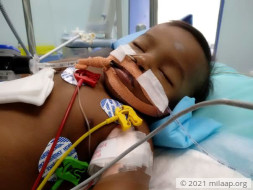 6-month-old’s Fever Escalated Into Liver Damage In Hours
