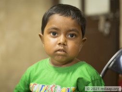 This 5-Year-Old’s Legs And Joints Are Swollen That She Can't Walk