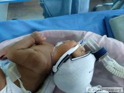 Help baby of Kala Prabha who is in urgent need of a surgery