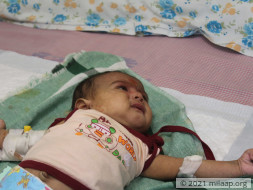 Every Passing Minute Is Crucial To 1-Month-Old Baby Without Treatment