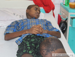 A Large Cancerous Tumor Will Kill This 14-Year-Old Without Urgent Help
