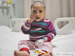 2-Year-Old Who Itches Till He Bleeds Needs A Transplant Urgently