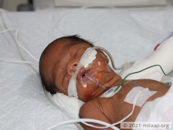 Helpless Mother Is Struggling To Save Her Premature Baby