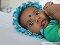 Only An Open Heart Surgery Will Save This 4-Month-Old's Life