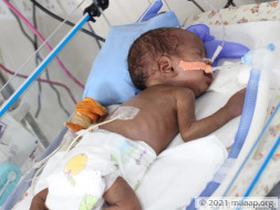 After Losing One Baby, This Couple Now Struggles to Save The Other