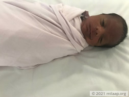 1-Month Old Born After Long Wait Will Turn Blind, Needs Urgent Help