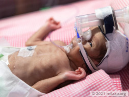 Help Baby of Mamatha to fight disease