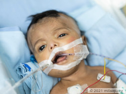 Severe Infection Will Spread From Baby’s Intestines To Her Entire Body