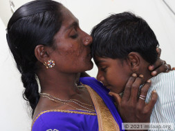 Gowtham Congenital needs your help to fight cardiac problem