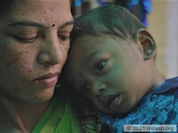Parents Starve To Feed 1-Year-Old Who Could Die Of Malnutrition