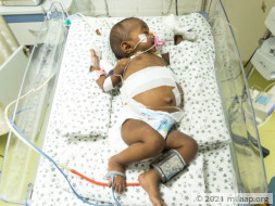 Baby of Naga Lakshmi needs your help to survive
