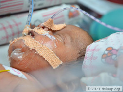 Help Baby of Priya Recover