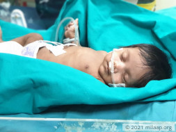 Baby of Mrs.Ganga Gore needs your help to survive