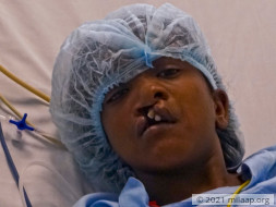 Help Sreebhadra Recover
