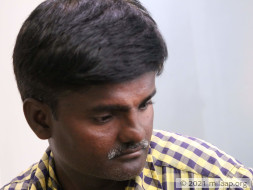 Help Nagaraj Undergo Open Heart Surgery