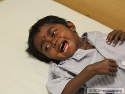Help Baby Laya Fight Chronic Liver Disease