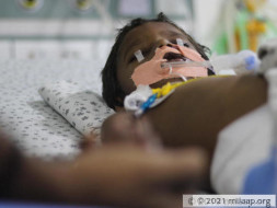 Help Avula Fight Acute Kidney Injury