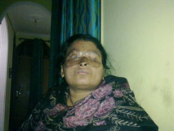 Fundraising to help acid attack survivor Anu undergo a medical surgery. Join this cause!