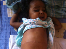 I am fundraising to buy book "Misha learns about money on Amazon to fund Baby Jhiya's treatment