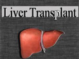 I am fundraising to husband's Liver Transplant