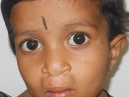 I am pledging my birthday to provide free surgical treatment for underprivileged patients