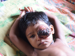 I am fundraising to treat the baby Manik Dhar who is battling with cancer