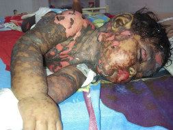 I am fundraising to help to save this 7 months old baby