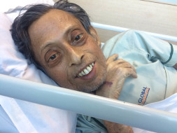 I am fundraising to help Fund A Liver Transplant Operation