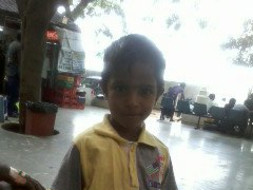 (TechMCSRChennai Team) We are fundraising to bone Marrow Transplantation Treatment