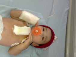 Help for an open heart surgery costs for a 4 days old baby