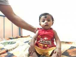 Support 5 mnth old angel Sayani's cancer treatment