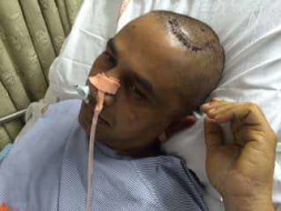 Shivaiah Bandari's Brain Stroke emergency Medical fund