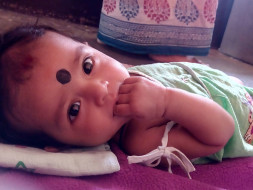 Help little Dimple for her Bone marrow transplant