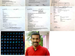 Help Mohan for Heart Surgery