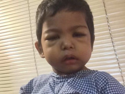 2yrs Baby Fighting with Liver Cell Failure