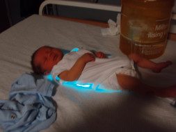 Help India fight Jaundice in Newborn