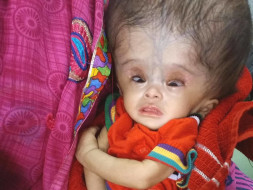 Support Diksha