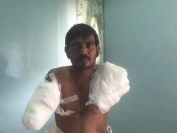 Help Rama - An Electric Line Man Who Lost Both Hands While On Duty!