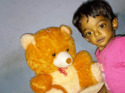 LIVER TRANSPLANTION Today (9-may-17) for my 2yr old son Kapil Abhinav