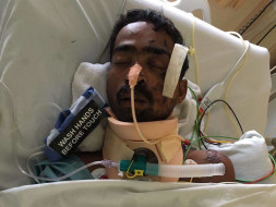 Help Accident Victim, Gautam Kamble Undergo A Crucial Surgery