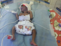 Help my premature Baby