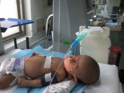 Help save baby Ghansham who's fighting against Shock& respiratory fail