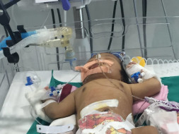 Help My Child to fight very rare disease Short Bowel Syndrome