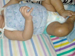Help Save The Life Of My 8-month-old Daughter
